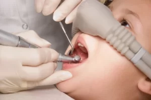 Pediatric dentistry with anesthesia